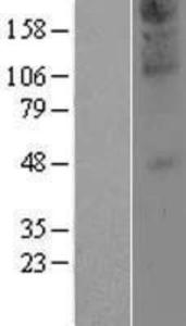 ZDHHC21 Lysate (Adult Normal), Novus Biologicals (NBP2-04950)