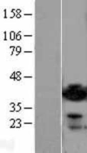 ADP-ribosylarginine hydrolase Overexpression Lysate (Adult Normal), Novus Biologicals (NBL1-07354)