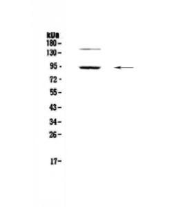 Anti-PDE4D Polyclonal Antibody