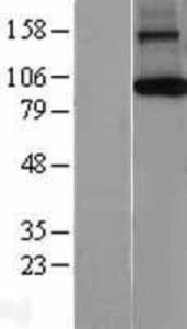 AGO1-EIF2C1 Overexpression lysate (adult normal)-western blot-NBL1-10182