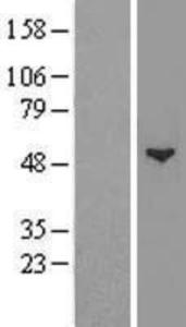 GCNT1 Lysate (Adult Normal), Novus Biologicals (NBP2-08272)
