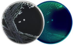 BCYE Selective agar (Buffered Charcoal Yeast Extract) with CCVC antibiotics