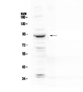 Anti-PLA2G6 Polyclonal Antibody