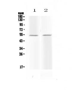 Anti-Protein C Polyclonal Antibody