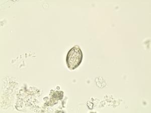 Human, Roundworm Eggs Slide
