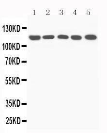 Anti-complement C5a Polyclonal Antibody