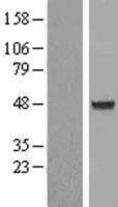 AIPL1 Overexpression lysate (adult normal)-western blot-NBL1-07416