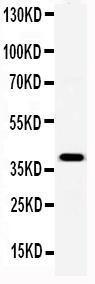 Anti-SAP/PTX2 Polyclonal Antibody