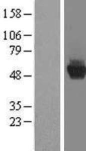 ADP-ribosylarginine hydrolase Overexpression Lysate (Adult Normal), Novus Biologicals (NBL1-07354)