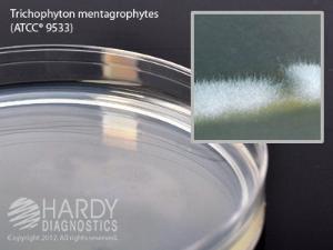 Potato Dextrose Agar with Chlortetracycline, Hardy Diagnostics