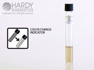 Moeller's Ornithine Decarboxylase, Hardy Diagnostics