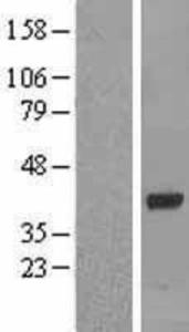 OAS1 Overexpression Lysate (Adult Normal), Novus Biologicals (NBL1-13896)