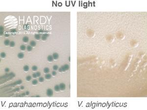 HardyCHROM™ Vibrio, Hardy Diagnostics