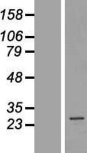 AKAP14 Overexpression Lysate (Adult Normal), Novus Biologicals (NBL1-07427)