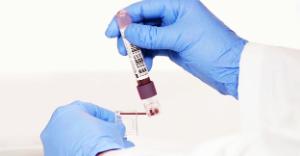 Hemocup collects blood sample from K2EDTA tube