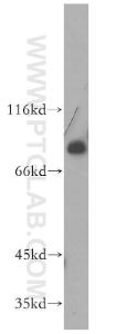 Anti-MDM4 Rabbit Polyclonal Antibody