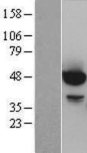AKT1 Overexpression lysate (adult normal)-western blot-NBP2-04280