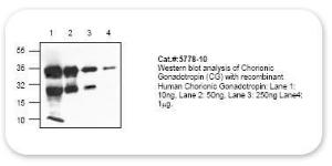 Anti-CGB Rabbit Polyclonal Antibody