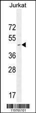 Western blot analysis in Jurkat cell line lysates (35 µg/lane)