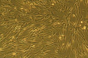 Human Mesenchymal Stem Cells Wharton's Jelly