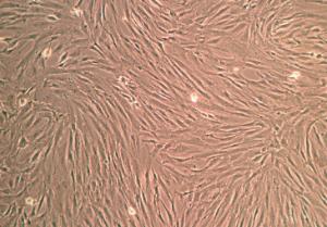 Human Mesenchymal Stem Cells Bone Marrow