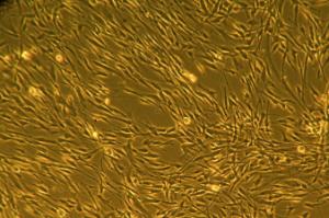 Human Mesenchymal Stem Cells Pre-Adipocytes
