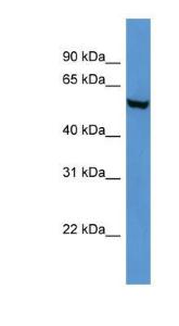 Anti-FTO Rabbit Polyclonal Antibody