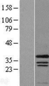 PRRX1 Overexpression Lysate (Adult Normal), Novus Biologicals (NBL1-14840)