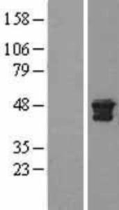 Sodium Potassium ATPase Alpha 3 Overexpression Lysate (Adult Normal), Novus Biologicals (NBL1-07809)