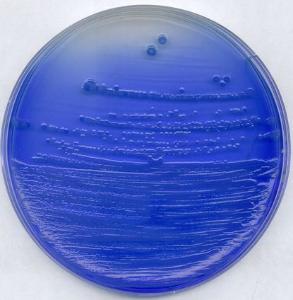 China blue-lactose agar