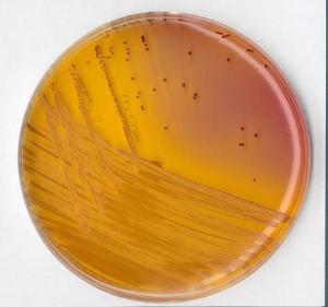 KF Streptococcus agar