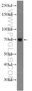 Anti-AP1G2 Rabbit Polyclonal Antibody