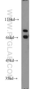 Anti-AARE Rabbit Polyclonal Antibody