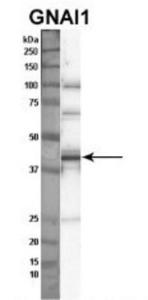 FKBP12 Overexpression Lysate (Adult Normal), Novus Biologicals (NBL1-10733)