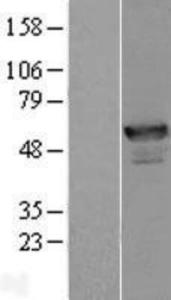 ANKMY2 Overexpression Lysate (Adult Normal), Novus Biologicals (NBL1-07531)