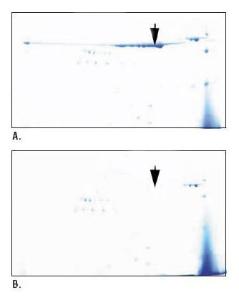 Pierce™ Albumin Depletion Kit, Thermo Scientific