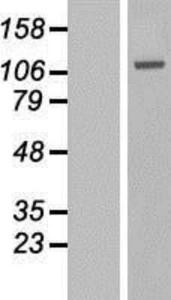 GAA Overexpression Lysate (Adult Normal), Novus Biologicals (NBL1-10902)