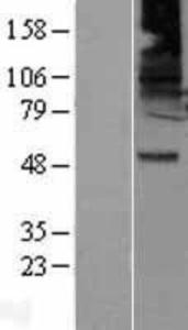 GABA A Receptor beta 2 Overexpression Lysate (Adult Normal), Novus Biologicals (NBL1-10921)