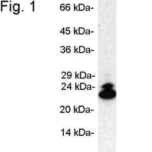 Anti-Proteasome 20S LMP2 Rabbit Polyclonal Antibody