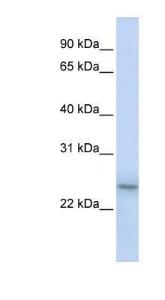 Anti-Proteasome 20S LMP2 Rabbit Polyclonal Antibody