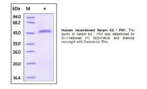 Human Recombinant MMP-14 (from <i>E. coli</i>)