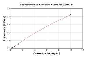 Representative standard curve for Human ALDH6A1 ELISA kit (A303115)