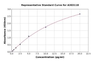 Representative standard curve for Human Anti-Ryanodine Receptor Antibody ELISA kit (A303118)