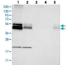 Anti-BNIP2 Rabbit Polyclonal Antibody