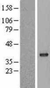 Protein Phosphatase 1C gamma Overexpression Lysate (Adult Normal), Novus Biologicals (NBL1-14673)