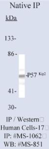 Anti-P57KIP2 Mouse Monoclonal Antibody [clone: 57P06]