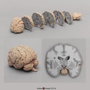 Advanced brain bundle