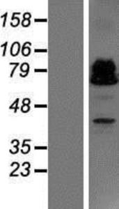 ZBTB46 Lysate (Adult Normal), Novus Biologicals (NBP2-06207)