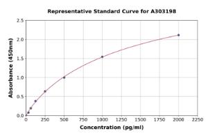 Representative standard curve for Human CCT2 ELISA kit (A303198)