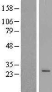 POLR3H Overexpression Lysate (Adult Normal), Novus Biologicals (NBL1-14596)